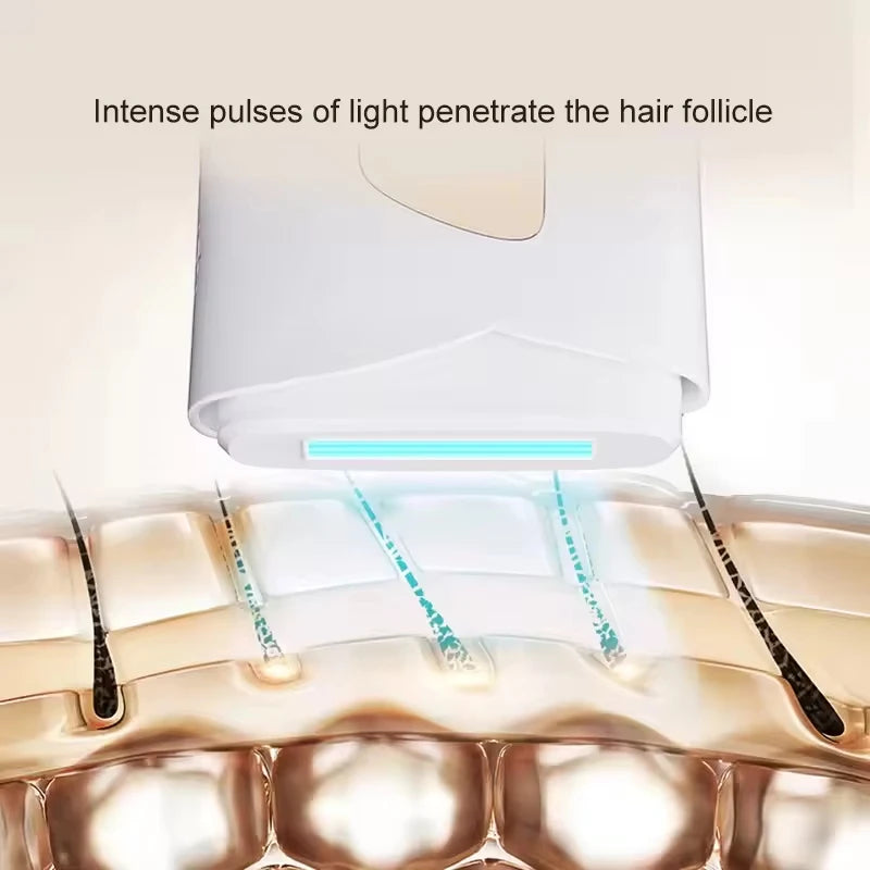 PAKISS At-Home IPL Hair Removal Device,Painless IPL Hair Removal System for Smooth Skin, Treats Underarm Leg Bikini Line